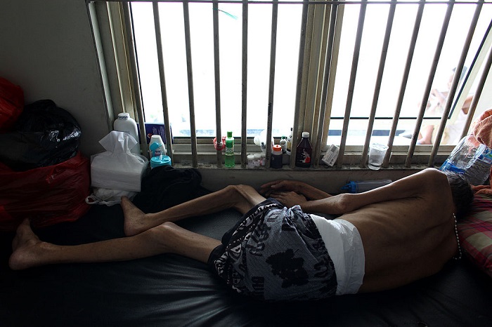 HIV stigma muting progress